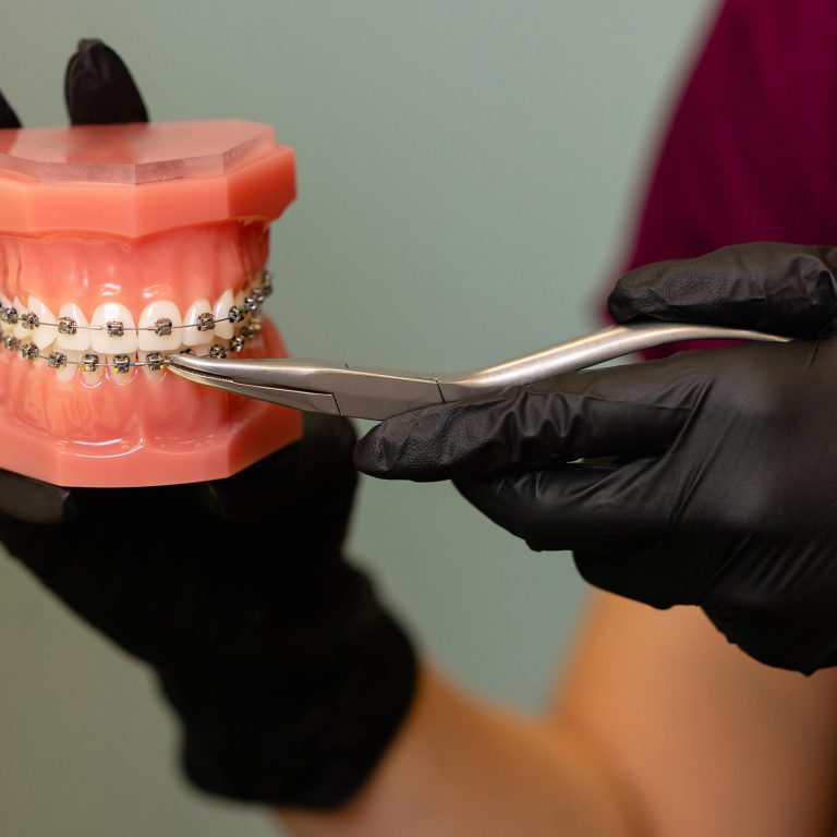 doctors-hands-holding-models-of-teeth-ceramic-brac-2025-03-10-13-28-31-utc (1)