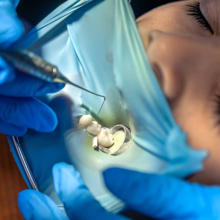 the-dentist-treats-the-child-s-tooth-using-a-rubbe-2025-03-18-14-08-16-utc (1)